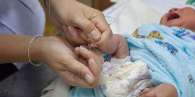 6 cause di bassa conta piastrinica nei neonati