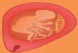 Avvolgere il cordone ombelicale attorno al collo del feto: quando diventare un rischio