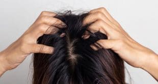 Cause della sensibilità del cuoio capelluto e metodi di trattamento
