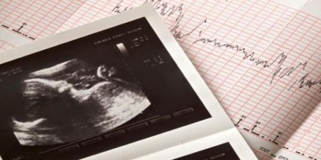 Crescita fetale durante la gravidanza mese per mese
