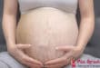 Quando iniziano le crepe addominali durante la gravidanza?