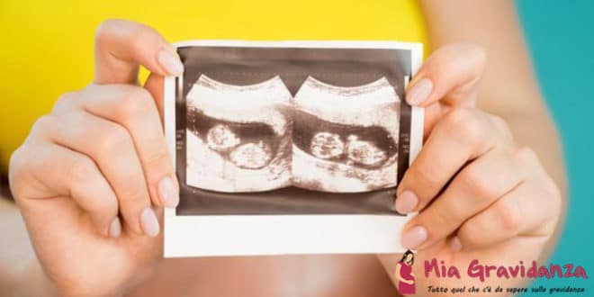 Quanto è salutare usare lo zenzero per una gravidanza gemellare?
