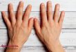 Le vene sporgenti della mano sono un segno di gravidanza?