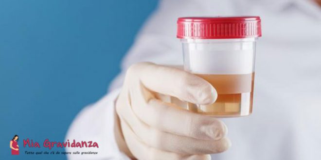 Quali sono le cause di un cambiamento nel colore delle urine in un rosso chiaro per una donna incinta?